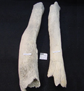 Foto: Tíbias deformadas em indivíduo pré-histórico como indício de sífilis.